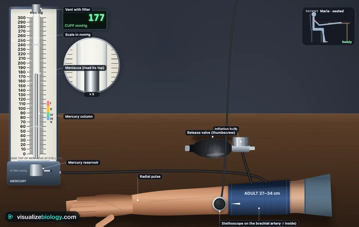 The simulator's bench: a desk mercury sphygmomanometer with its column at about 177 mmHg and a magnifier on the meniscus, a navy cuff on a patient's upper arm, the black inflation bulb with its release valve and a stethoscope on the brachial artery in the elbow crease