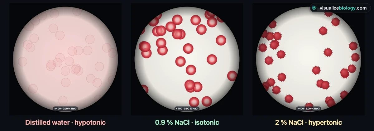 Red blood cells at 400x in three solutions: burst ghosts in distilled water, biconcave discs in 0.9 percent saline and crenated spiky cells in 2 percent saline