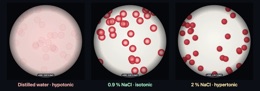 Red blood cells in three solutions