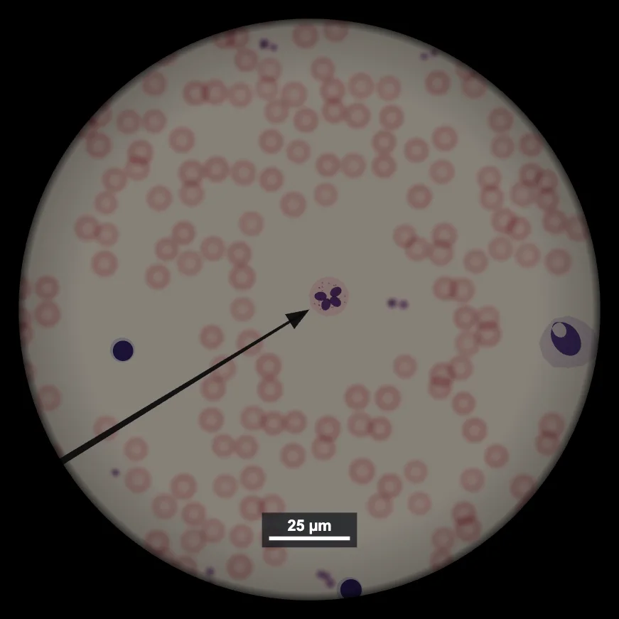 Human blood smear at 1000x with oil immersion showing red blood cells, a neutrophil and platelets