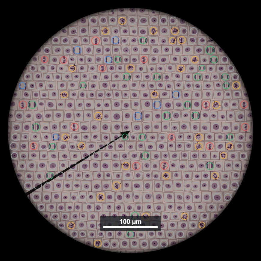 Root tip cells ringed by colour for each stage of mitosis by the auto-count tool at 400x