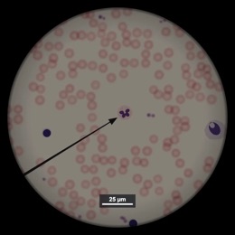 Blood smear image used in an identification question