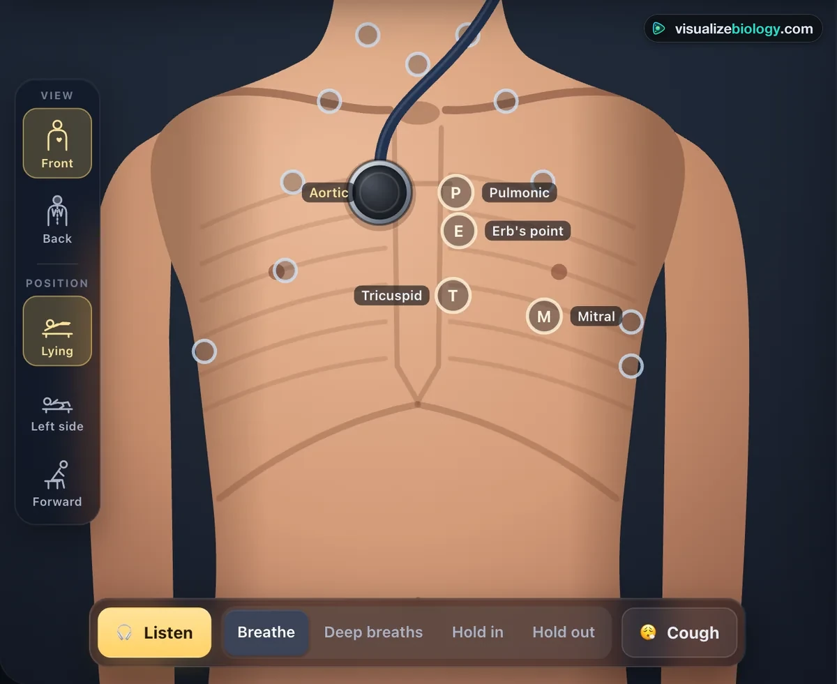 The front of the chest in the simulator with the aortic, pulmonic, Erb's point, tricuspid and mitral listening posts labelled with their letters A, P, E, T and M, the chest piece on the aortic area and further lung and neck sites marked as rings
